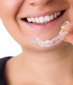 Woman inserting Invisalign into her mouth